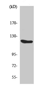 Western blot - Anti-FGFR1 antibody (AB63601)