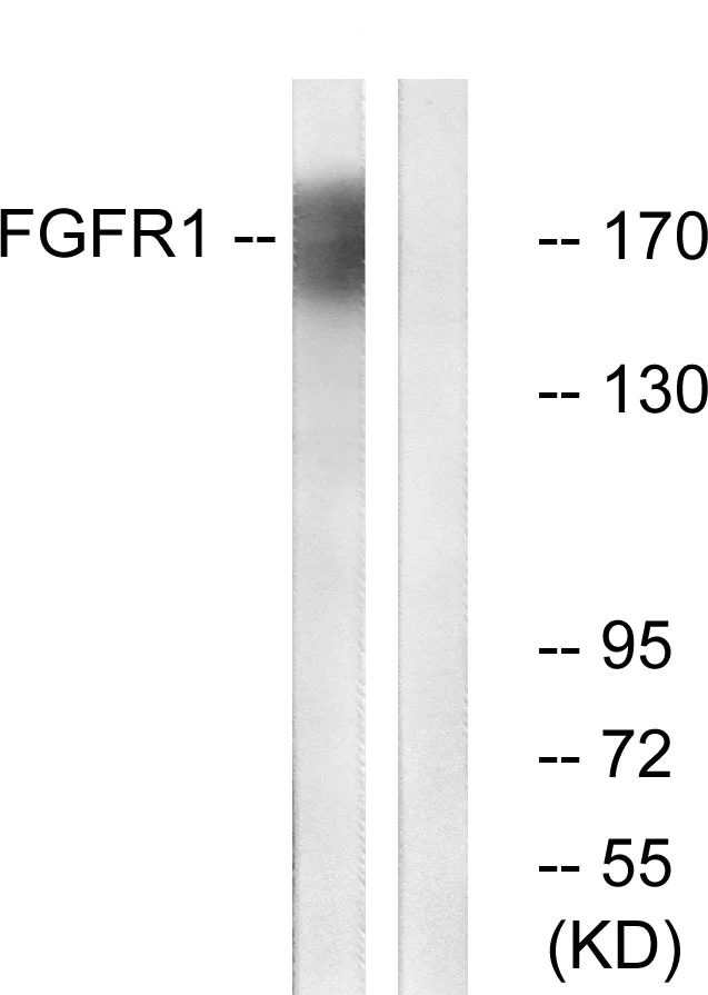 Western blot - Anti-FGFR1 antibody (AB63601)