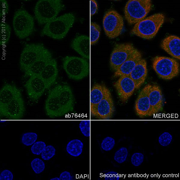 Immunocytochemistry/ Immunofluorescence - Anti-FGFR1 antibody [EPR806Y] (AB76464), expandable thumbnail