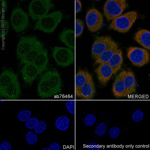 Immunocytochemistry/ Immunofluorescence - Anti-FGFR1 antibody [EPR806Y] (AB76464)