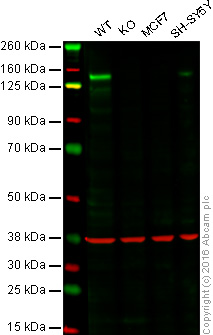 Western blot - Anti-FGFR1 antibody [EPR806Y] (AB76464), expandable thumbnail