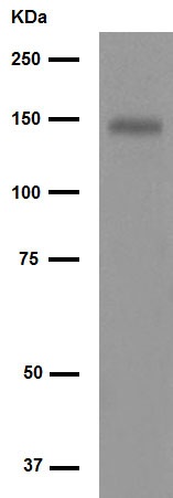 Western blot - Anti-FGFR1 antibody [EPR806Y] (AB76464), expandable thumbnail