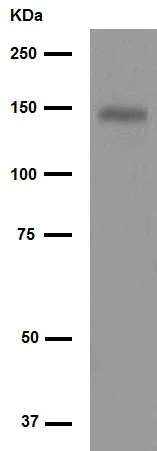 Western blot - Anti-FGFR1 antibody [EPR806Y] (AB76464)