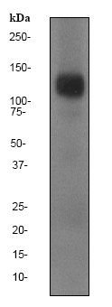 Western blot - Anti-FGFR1 antibody [EPR806Y] (AB76464), expandable thumbnail