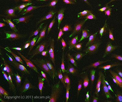 Immunocytochemistry/ Immunofluorescence - Anti-FGFR1 antibody [M5G10] (AB824), expandable thumbnail