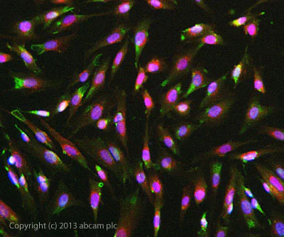 Immunocytochemistry/ Immunofluorescence - Anti-FGFR1 antibody [M5G10] (AB824)