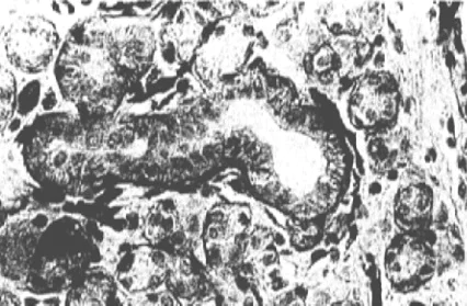 Immunohistochemistry (Formalin/PFA-fixed paraffin-embedded sections) - Anti-FGFR1 antibody [M5G10] (AB824)