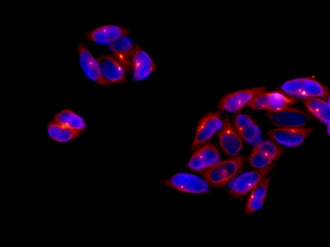 Immunocytochemistry/ Immunofluorescence - Anti-FGFR1 Oncogene Partner antibody [EPR9929] (AB156013)