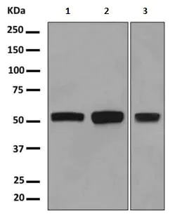 Western blot - Anti-FGFR1 Oncogene Partner antibody [EPR9929] (AB156013)