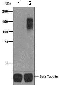 Western blot - Anti-FGFR1 (phospho Y653) antibody [EPR843(N)] (AB173305)