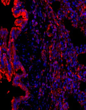 Immunocytochemistry/ Immunofluorescence - Anti-FGFR1 (phospho Y654) antibody (AB59194)