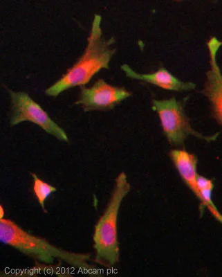 Immunocytochemistry/ Immunofluorescence - Anti-FGFR1 (phospho Y654) antibody (AB59194)