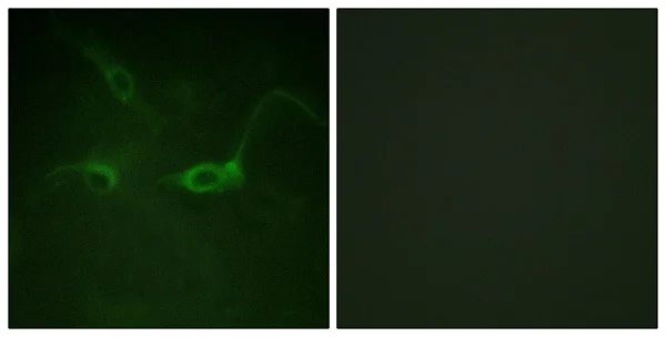 Immunocytochemistry/ Immunofluorescence - Anti-FGFR1 (phospho Y654) antibody (AB59194)