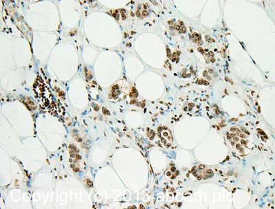 Immunohistochemistry (Formalin/PFA-fixed paraffin-embedded sections) - Anti-FGFR1 (phospho Y654) antibody (AB59194)