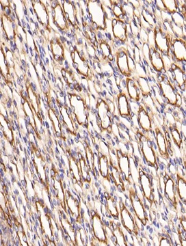 Immunohistochemistry (Formalin/PFA-fixed paraffin-embedded sections) - Anti-FGFR1 (phospho Y654) antibody (AB59194)