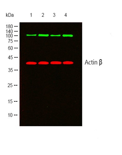 Western blot - Anti-FGFR1 (phospho Y654) antibody (AB59194)