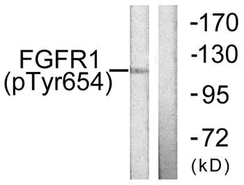Western blot - Anti-FGFR1 (phospho Y654) antibody (AB59194)