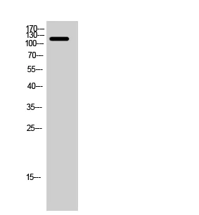Western blot - Anti-FGFR1 (phospho Y654) antibody (AB59194)