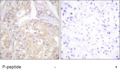 Immunohistochemistry (Formalin/PFA-fixed paraffin-embedded sections) - Anti-FGFR1 (phospho Y766) antibody (AB59180)