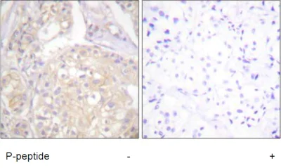 Immunohistochemistry (Formalin/PFA-fixed paraffin-embedded sections) - Anti-FGFR1 (phospho Y766) antibody (AB59180)