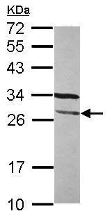 Western blot - Anti-FGFR1OP2 antibody (AB229119)