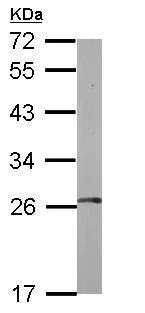 Western blot - Anti-FGFR1OP2 antibody (AB229119)