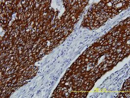 Immunohistochemistry (Formalin/PFA-fixed paraffin-embedded sections) - Anti-FGFR2 antibody [1G3] (AB58201)