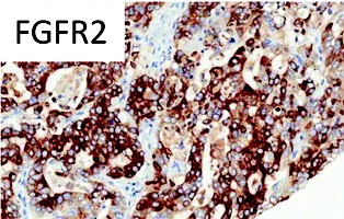 Immunohistochemistry (Formalin/PFA-fixed paraffin-embedded sections) - Anti-FGFR2 antibody [1G3] (AB58201)