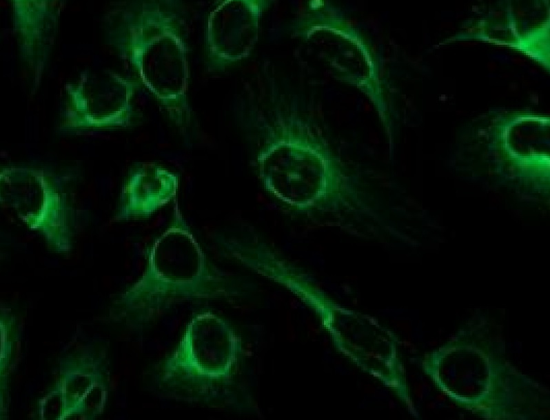 Immunocytochemistry/ Immunofluorescence - Anti-FGFR2 antibody (AB235277)