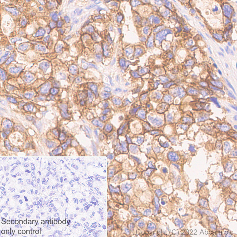 Immunohistochemistry (Formalin/PFA-fixed paraffin-embedded sections) - Anti-FGFR2 antibody [EPR24075-418] (AB289968), expandable thumbnail
