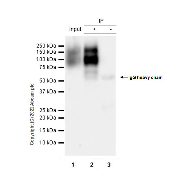Immunoprecipitation - Anti-FGFR2 antibody [EPR24075-418] (AB289968), expandable thumbnail