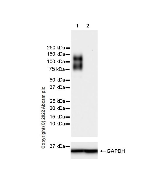 Western blot - Anti-FGFR2 antibody [EPR24075-418] (AB289968), expandable thumbnail