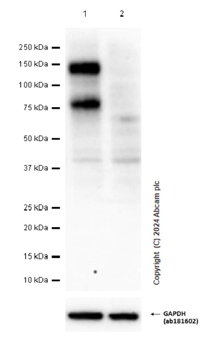 Western blot - Anti-FGFR2 antibody [EPR24075-418] (AB289968)
