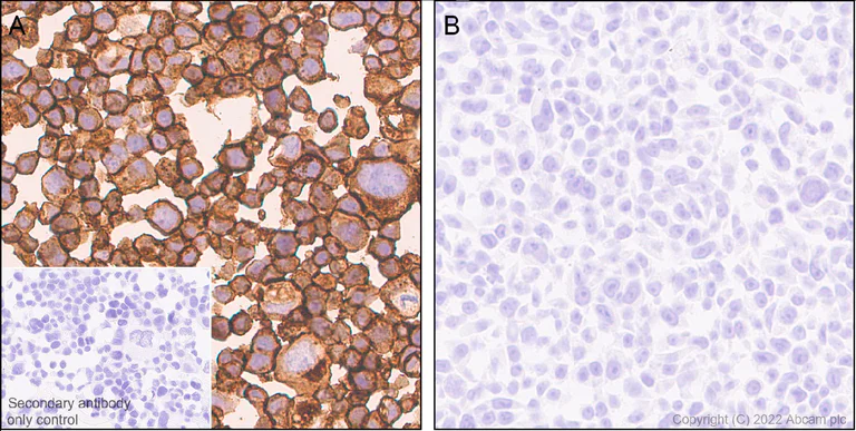 Immunohistochemistry (Formalin/PFA-fixed paraffin-embedded sections) - Anti-FGFR2 antibody [EPR24075-418] - BSA and Azide free (AB289993)