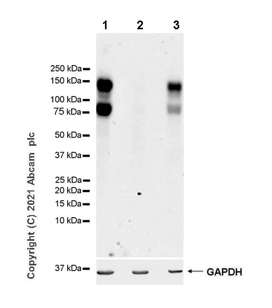 Western blot - Anti-FGFR2 antibody [EPR24679-79] (AB281925)