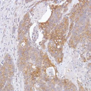 Immunohistochemistry (Formalin/PFA-fixed paraffin-embedded sections) - Anti-FGFR2 antibody [SP273] - BSA and Azide free (AB272012)
