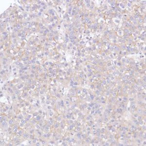 Immunohistochemistry (Formalin/PFA-fixed paraffin-embedded sections) - Anti-FGFR2 antibody [SP273] - BSA and Azide free (AB272012)