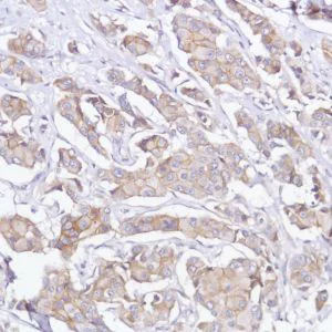 Immunohistochemistry (Formalin/PFA-fixed paraffin-embedded sections) - Anti-FGFR2 antibody [SP273] - N-terminal (AB227683)