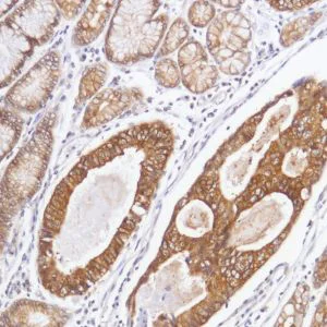 Immunohistochemistry (Formalin/PFA-fixed paraffin-embedded sections) - Anti-FGFR2 antibody [SP273] - N-terminal (AB227683)