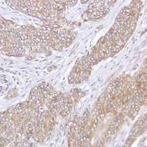 Immunohistochemistry (Formalin/PFA-fixed paraffin-embedded sections) - Anti-FGFR2 antibody [SP273] - N-terminal (AB227683)