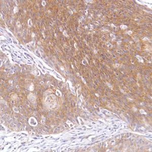 Immunohistochemistry (Formalin/PFA-fixed paraffin-embedded sections) - Anti-FGFR2 antibody [SP273] - N-terminal (AB227683)