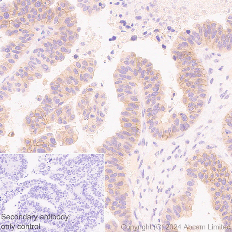 Immunohistochemistry (Formalin/PFA-fixed paraffin-embedded sections) - Anti-FGFR2IIIb/FGFR2b antibody [EPR30797-567] (AB322553)