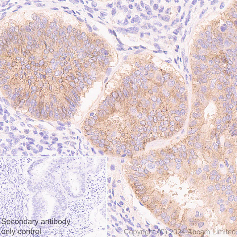 Immunohistochemistry (Formalin/PFA-fixed paraffin-embedded sections) - Anti-FGFR2IIIb/FGFR2b antibody [EPR30797-567] (AB322553)