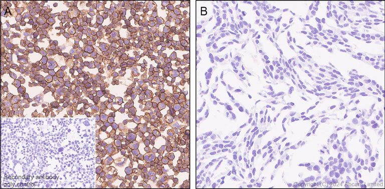 Immunohistochemistry (Formalin/PFA-fixed paraffin-embedded sections) - Anti-FGFR2IIIb/FGFR2b antibody [EPR30797-567] (AB322553)