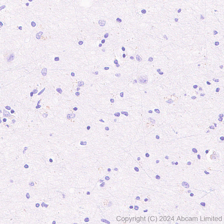 Immunohistochemistry (Formalin/PFA-fixed paraffin-embedded sections) - Anti-FGFR2IIIb/FGFR2b antibody [EPR30797-567] (AB322553)