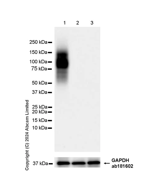 Western blot - Anti-FGFR2IIIb/FGFR2b antibody [EPR30797-567] (AB322553)