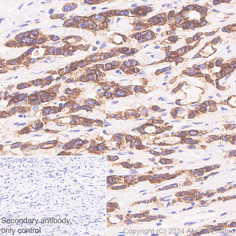 Immunohistochemistry (Formalin/PFA-fixed paraffin-embedded sections) - Anti-FGFR2IIIb/FGFR2b antibody [EPR30797-567] - BSA and Azide free (AB325965)