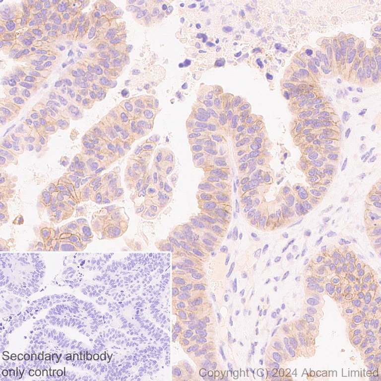 Immunohistochemistry (Formalin/PFA-fixed paraffin-embedded sections) - Anti-FGFR2IIIb/FGFR2b antibody [EPR30797-567] - BSA and Azide free (AB325965)