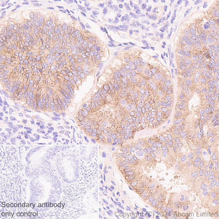 Immunohistochemistry (Formalin/PFA-fixed paraffin-embedded sections) - Anti-FGFR2IIIb/FGFR2b antibody [EPR30797-567] - BSA and Azide free (AB325965)
