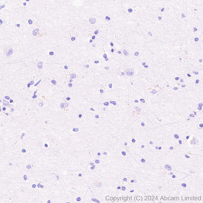 Immunohistochemistry (Formalin/PFA-fixed paraffin-embedded sections) - Anti-FGFR2IIIb/FGFR2b antibody [EPR30797-567] - BSA and Azide free (AB325965)